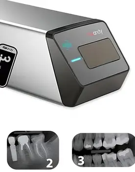 Šikovný Značky Fosfor Doska Digital Zubné X Ray Scanner Senzor